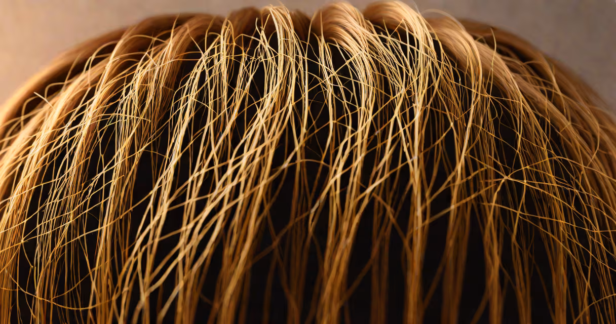 Close-up of healthy scalp with visible hair follicles under medical lighting